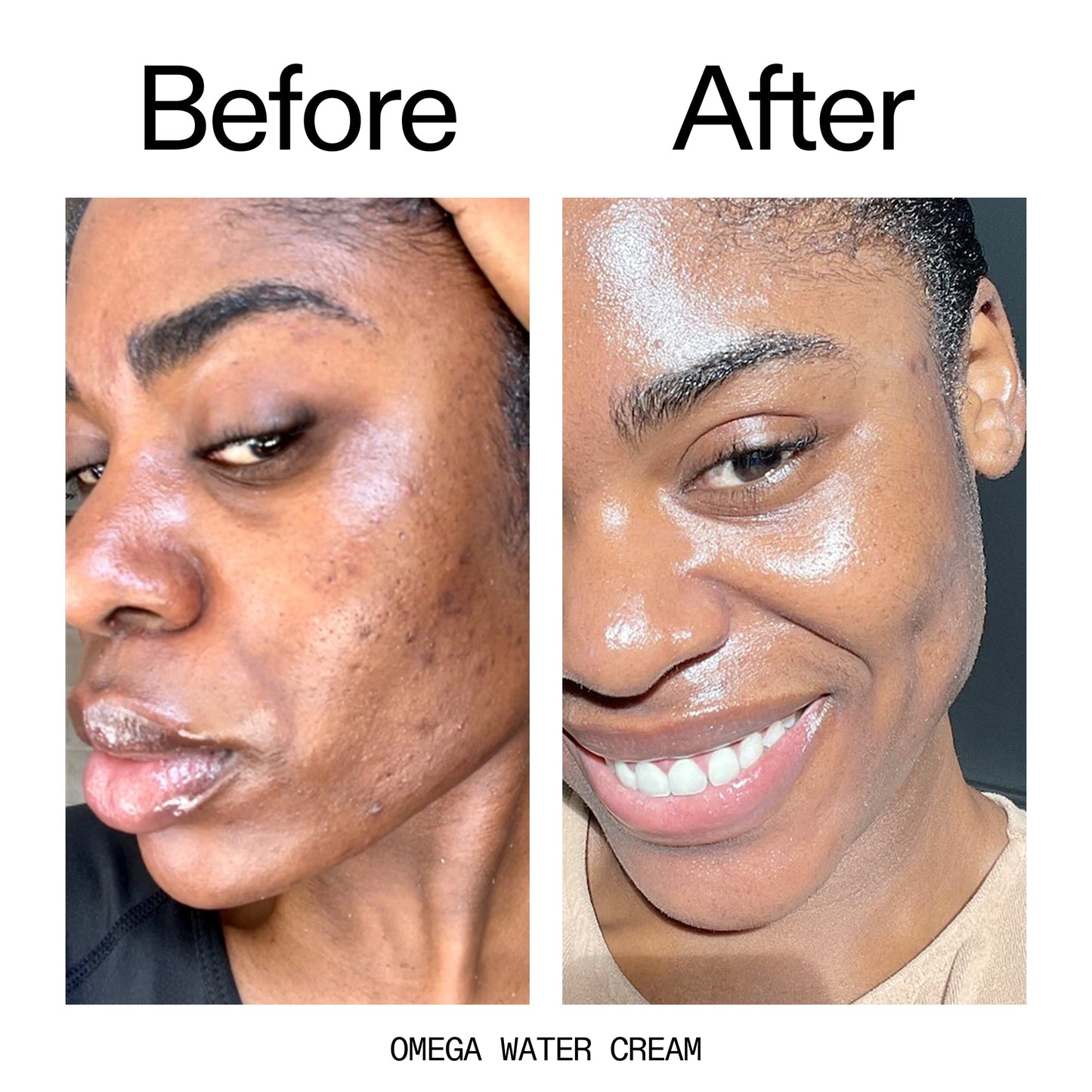 glowing-skin-set-l3 Omega_Water_Cream_Before_After_2000x2000_8e88278b-8c8d-48dc-ac77-4e98ebbd1b77.jpg