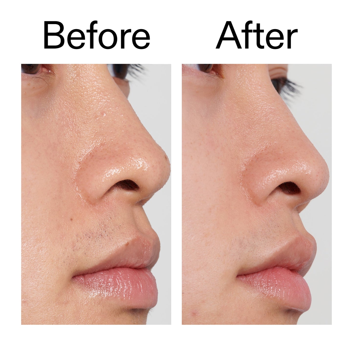 pha-toner-b0 PHA_Toner_Before_After_2000x2000_e3c10172-0150-4342-8b95-57417eaff50d.jpg