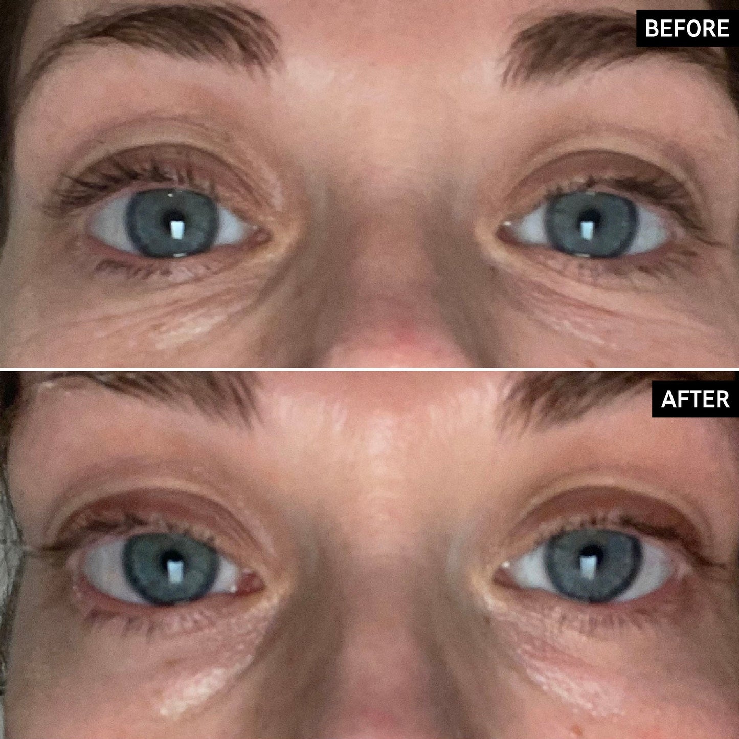 retinol-eye-cream-y9 SITE-UGCBAsApril_Nicole_B_A_PPage_2000x2000_1.jpg