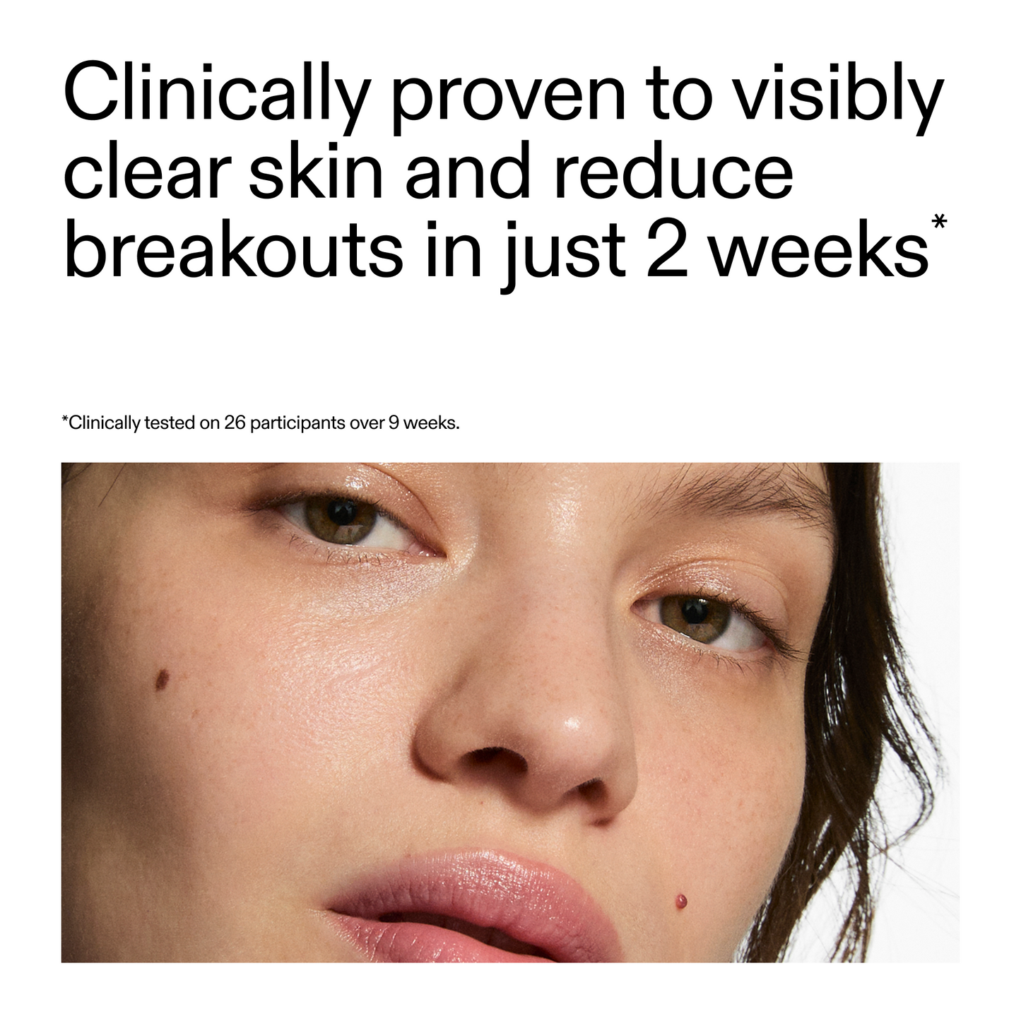 360-acne-clearing-duo-u3 360_Serum_Key_Claim.png