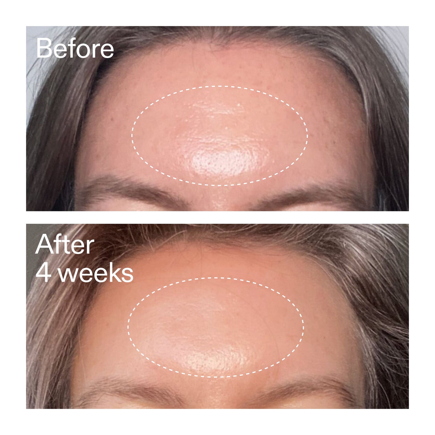 advanced-0-2-retinal-serum-duo-g7 AdvancedRetinal_BeforeAfter1_2000x2000_4e9c798a-f30e-45b8-a34a-7c4740f2f2cb.jpg