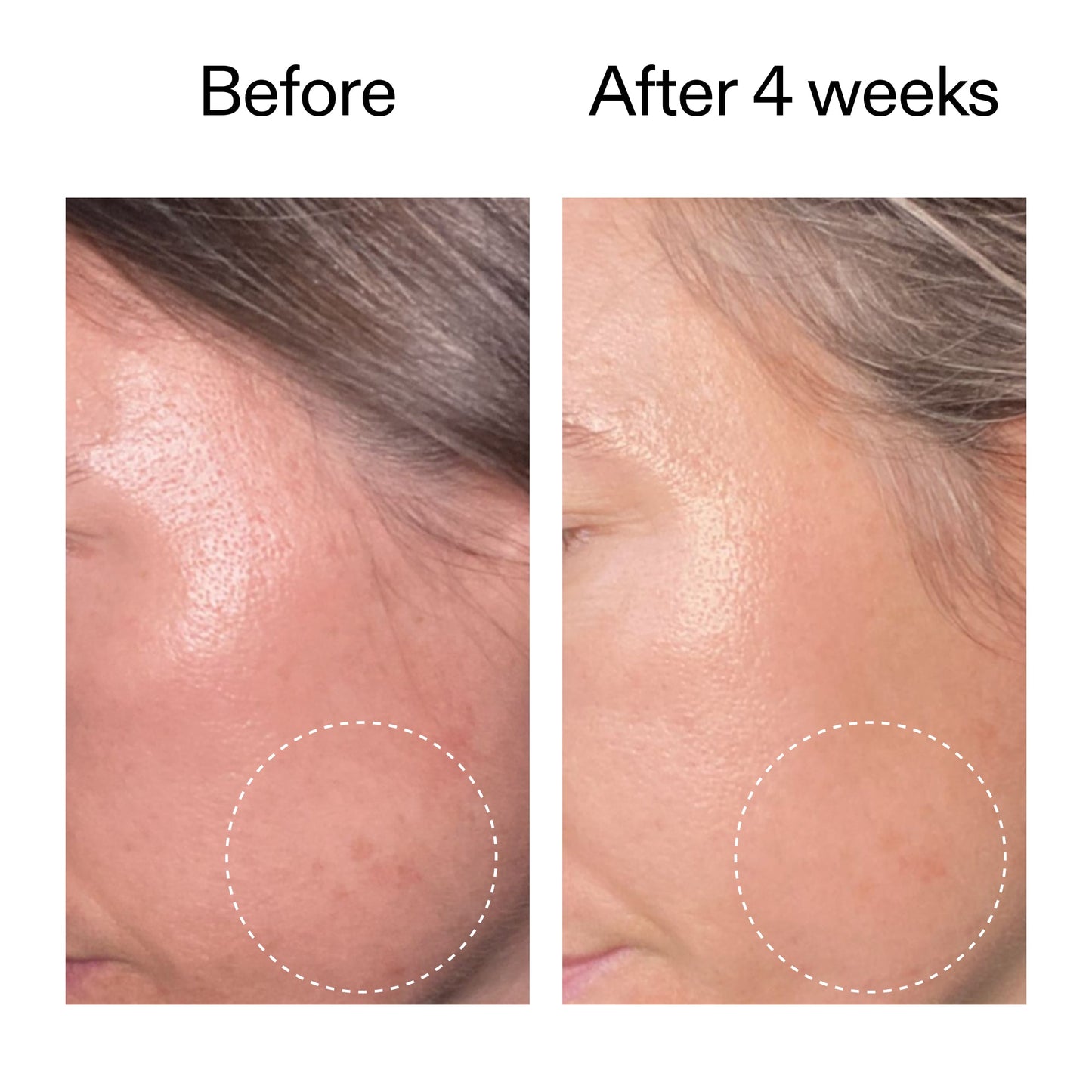 advanced-0-2-retinal-serum-duo-g7 AdvancedRetinal_BeforeAfter2__2000x2000_8ef75542-2316-4814-81ee-0f66a85912bc.jpg