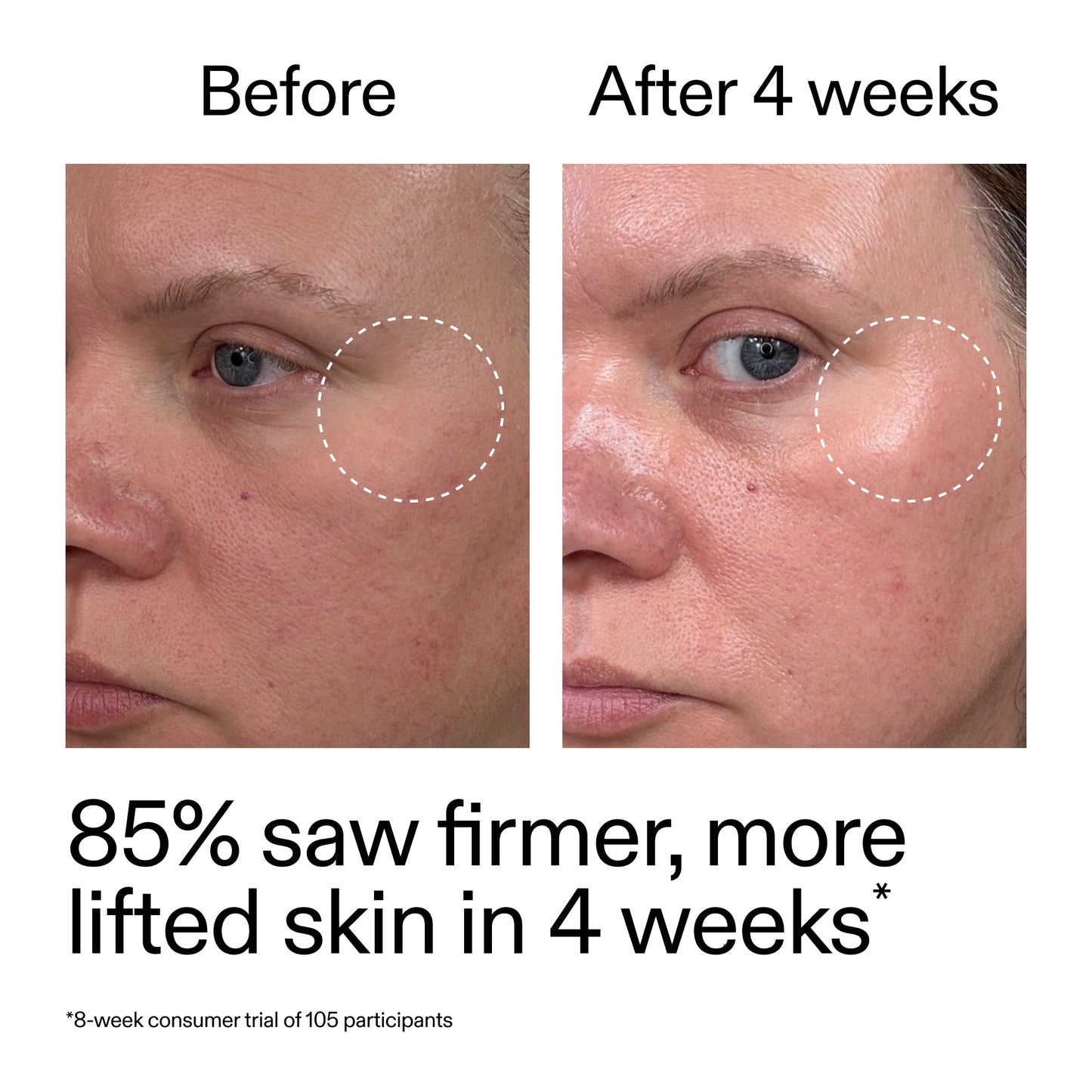 advanced-0-2-retinal-serum-p4 AdvancedRetinal_BeforeAfter_Claim1_2000x2000_bcc385c4-5e73-4f1e-aba8-64267937d0d3.jpg