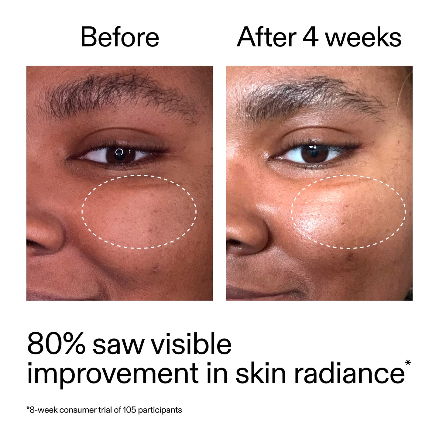 advanced-0-2-retinal-serum-p4 AdvancedRetinal_BeforeAfter_Claim2_2000x2000_39d11e3d-eda9-44ec-ab32-2903b1a368bd.jpg
