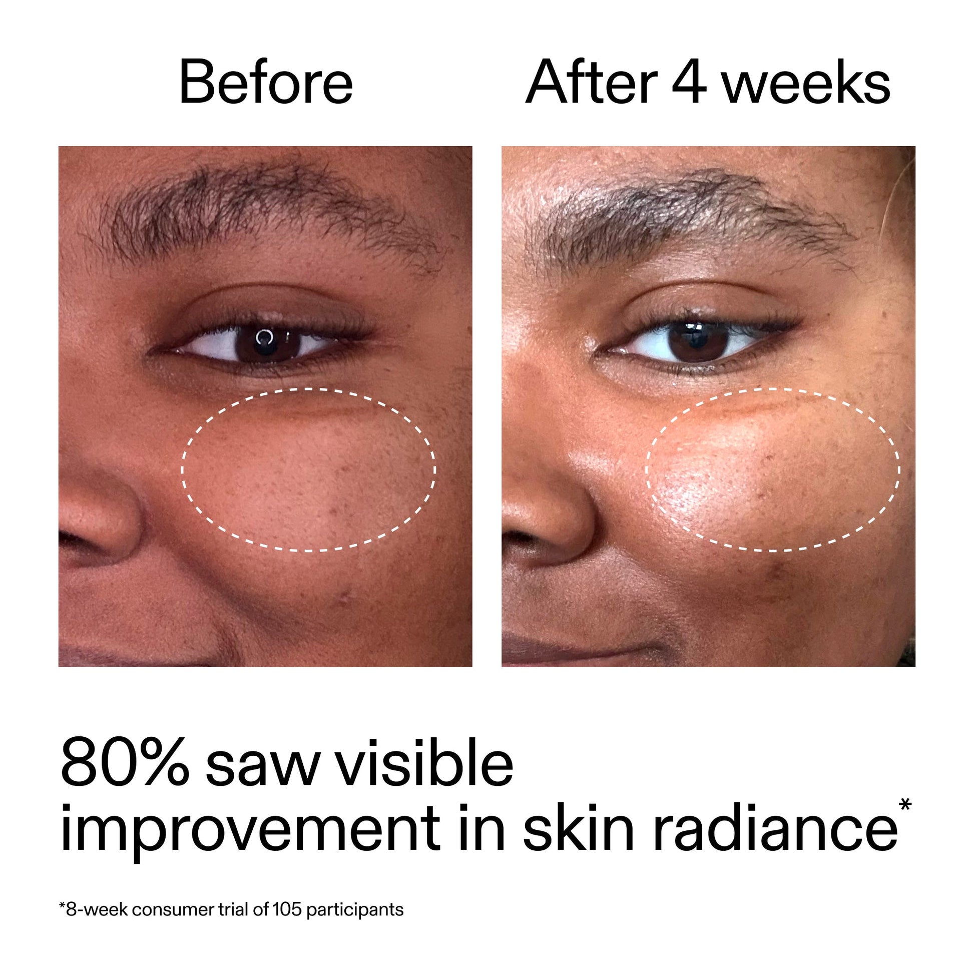 advanced-0-2-retinal-serum-p4 AdvancedRetinal_BeforeAfter_Claim2_2000x2000_39d11e3d-eda9-44ec-ab32-2903b1a368bd.jpg