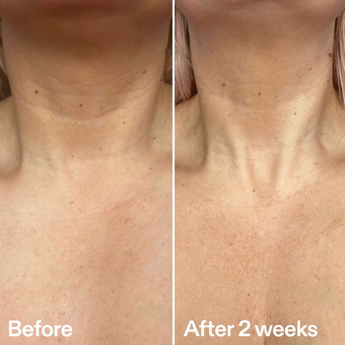 bio-active-neck-lift-stick-x2 B_A_2.jpg