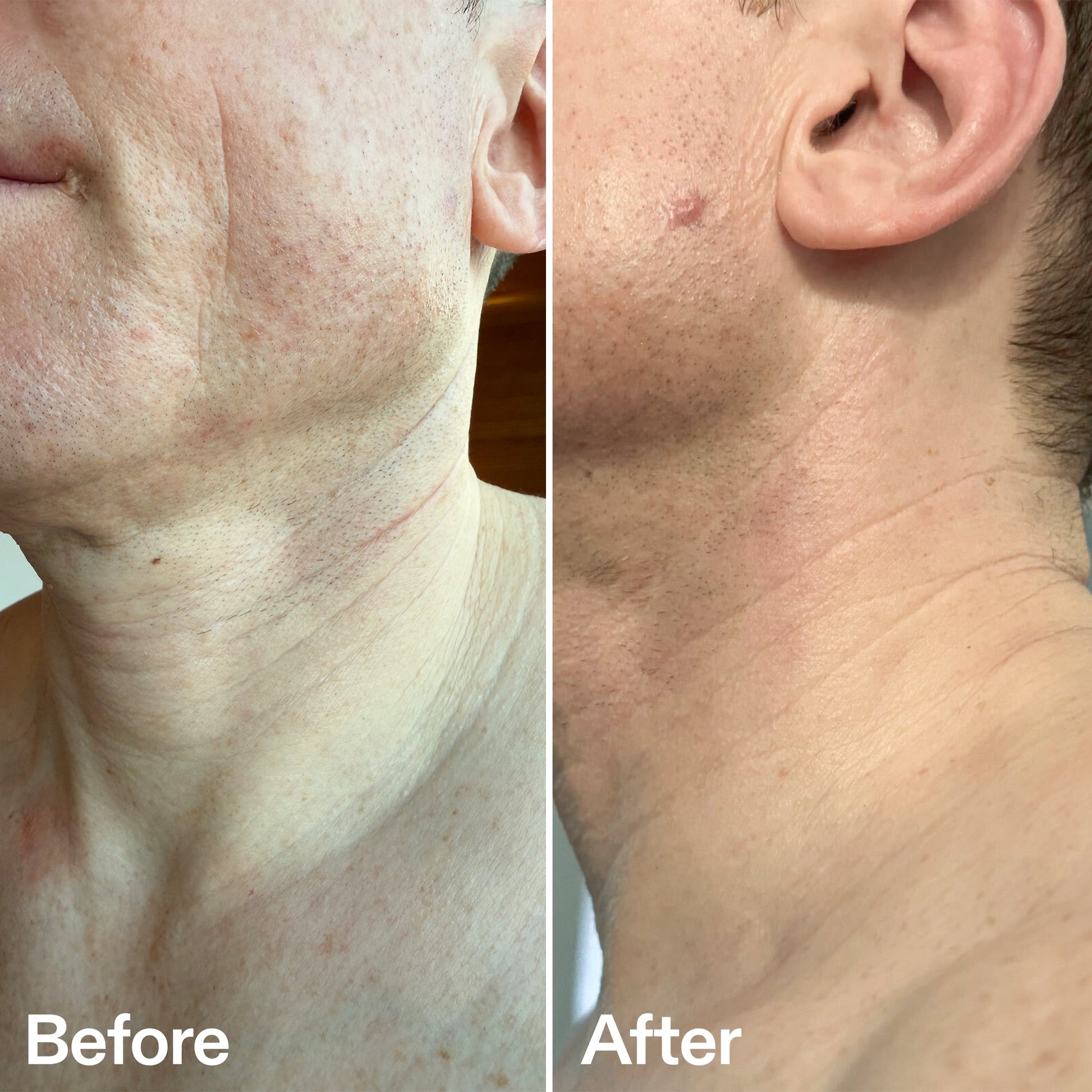 bio-active-neck-lift-stick-x2 B_A_afa2743e-b8e2-4504-92f4-e281cb6cf759.jpg