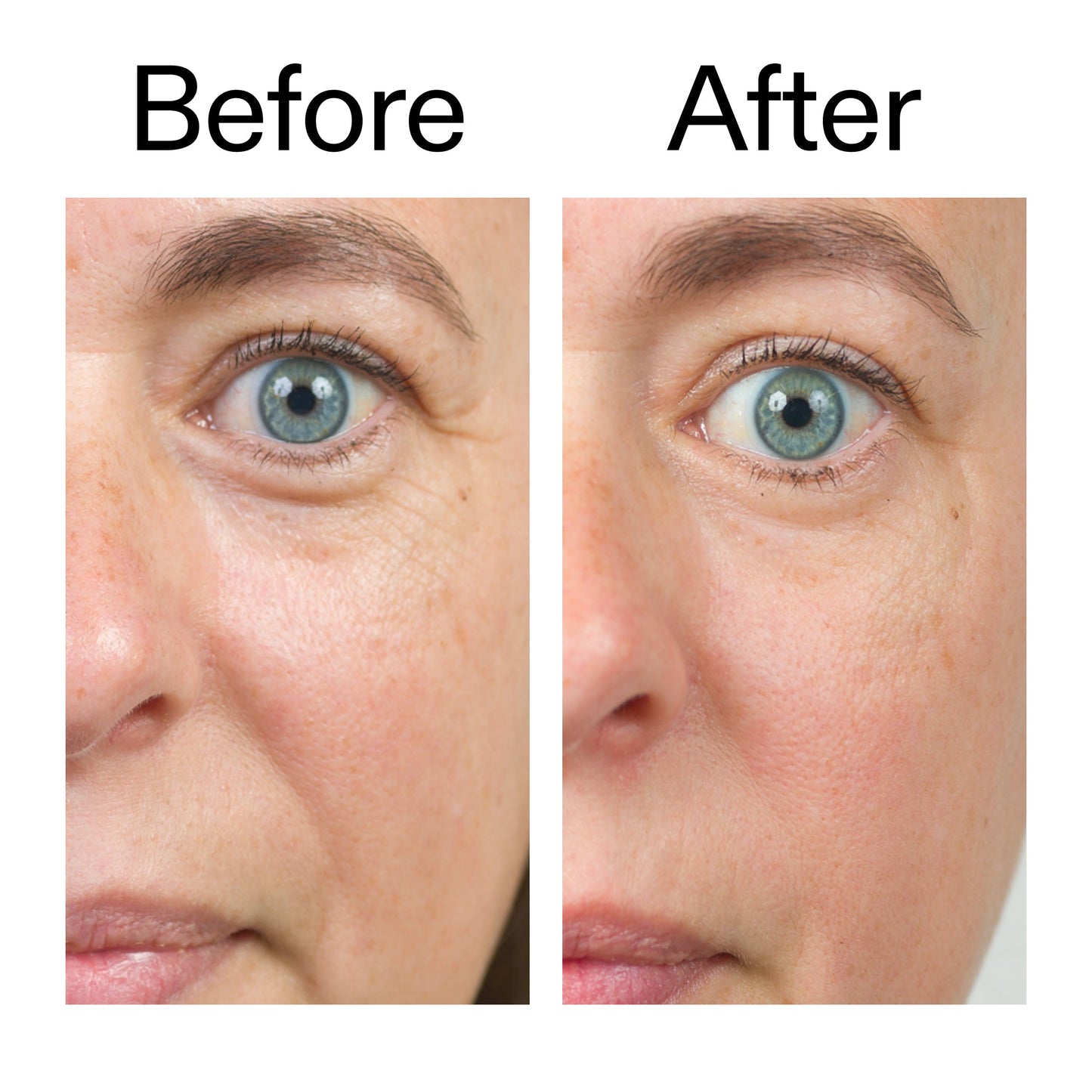 bio-active-ceramide-moisturizer-duo-j2 Bio-Active_Before_After_2000x2000_566e5a9e-135e-417a-8242-b44e5fa35463.jpg