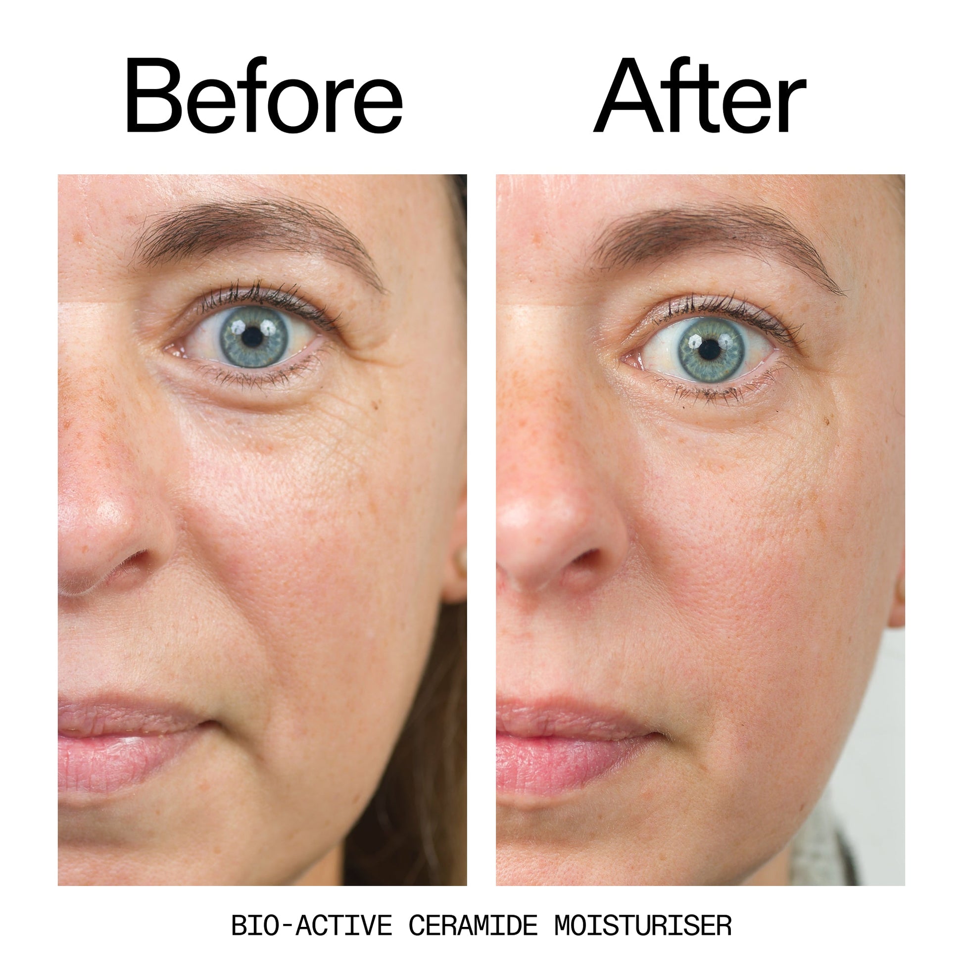 barrier-boosting-trio-d9 Bio-Active_Before_After_2000x2000_600947b4-e8c5-425a-9155-fc15bc83aa12.jpg