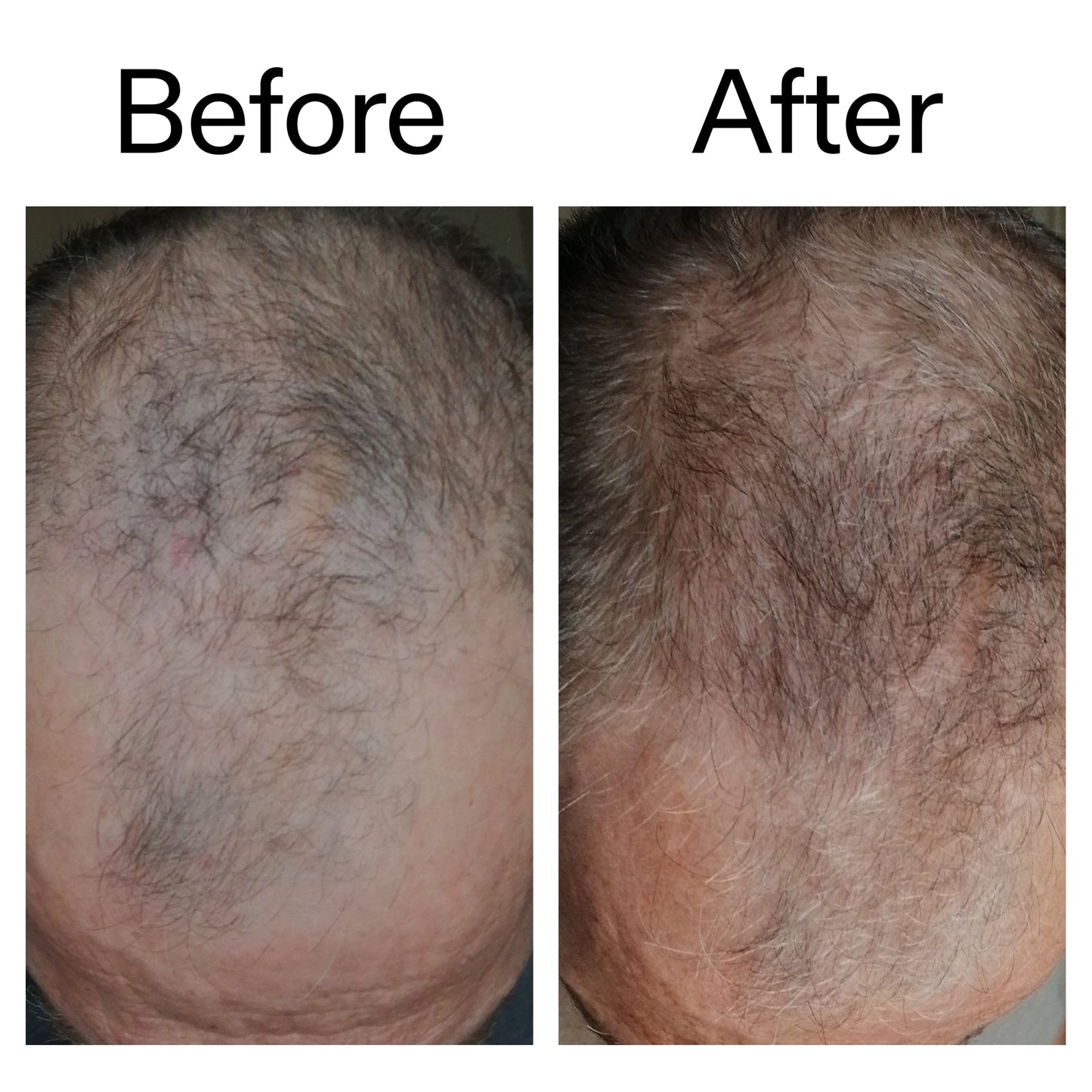 3-month-hair-growth-trio-d1 Caffeine_Scalp_Treatment_B_A_Ppage_2000_x_2000.jpg