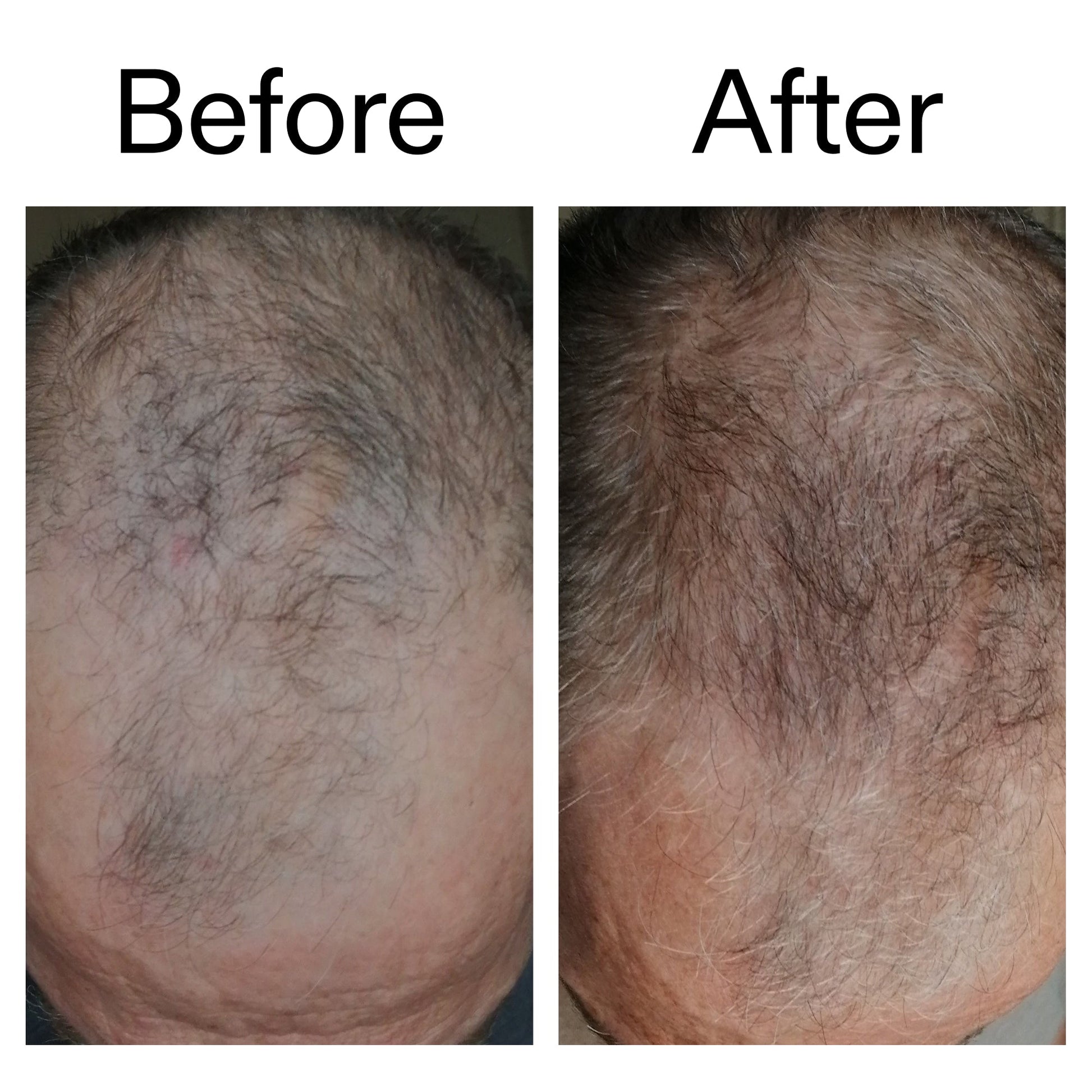 3-month-hair-growth-trio-d1 Caffeine_Scalp_Treatment_B_A_Ppage_2000_x_2000.jpg