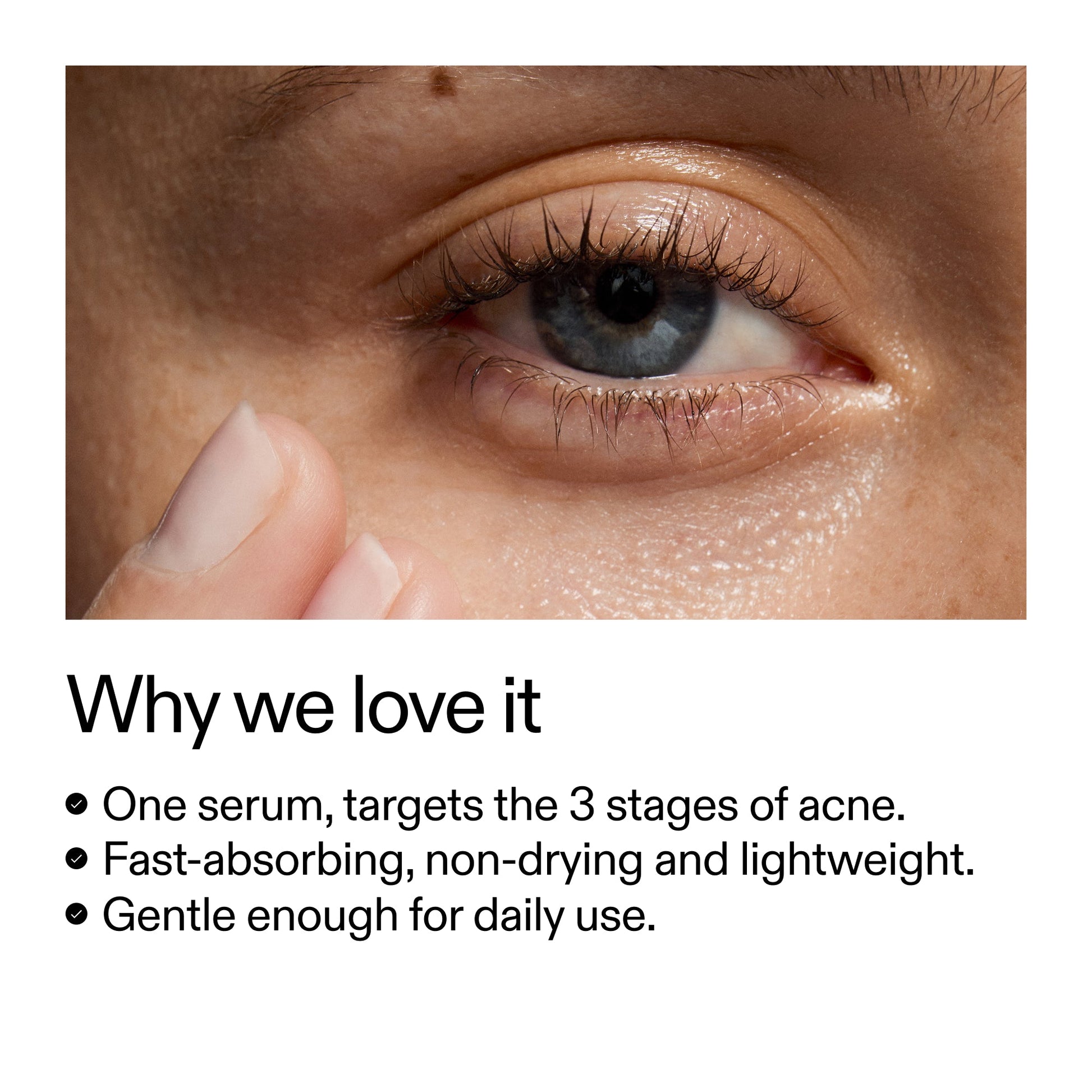 360-acne-clearing-serum-c6 Dioic_Whyweloveit_2000x2000_175aafd3-0cbe-403a-b317-a8362881bfe2.jpg