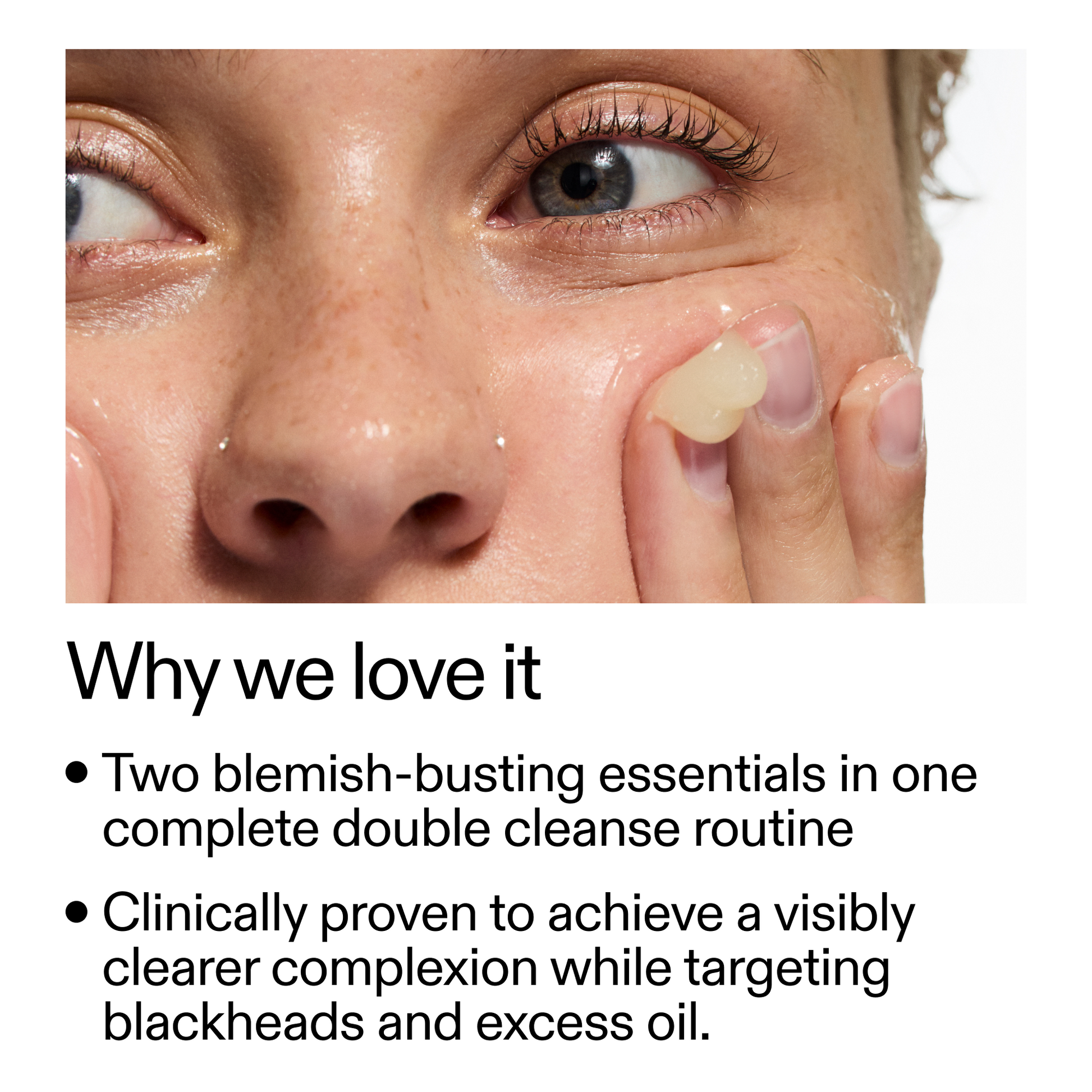 acne-double-cleanse-duo-l1 Double_Cleanse_Duo_for_Breakouts_Why_We_2000x2000_f242cb12-bb5c-487c-b203-071ccb406ec5.png