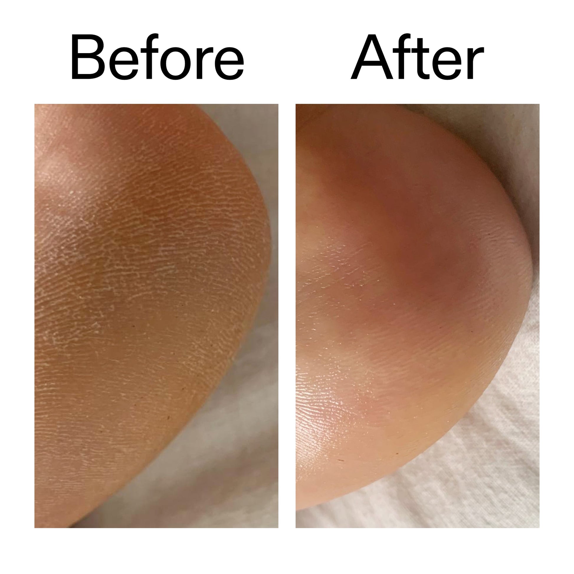glycolic-acid-exfoliating-body-stick-e1 Glycolic_Acid_Exfoliating_Body_Stick_Before_After_V1_2000x2000_a3043625-9400-429a-a7fb-d6dbd220f722.jpg