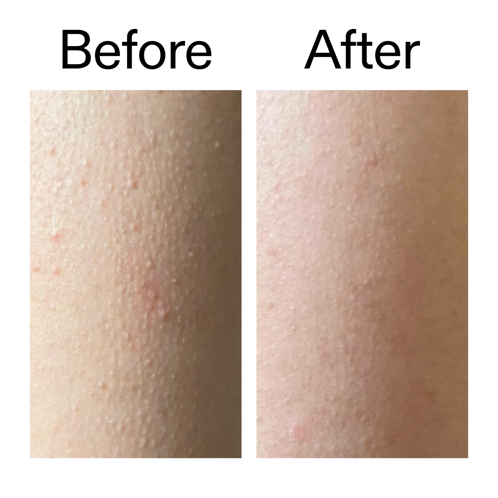 glycolic-acid-exfoliating-body-stick-e1 Glycolic_Acid_Exfoliating_Body_Stick_Before_After_V2_2000x2000_2e4ba052-94f6-4d56-82df-7bdb5b2df7ae.jpg