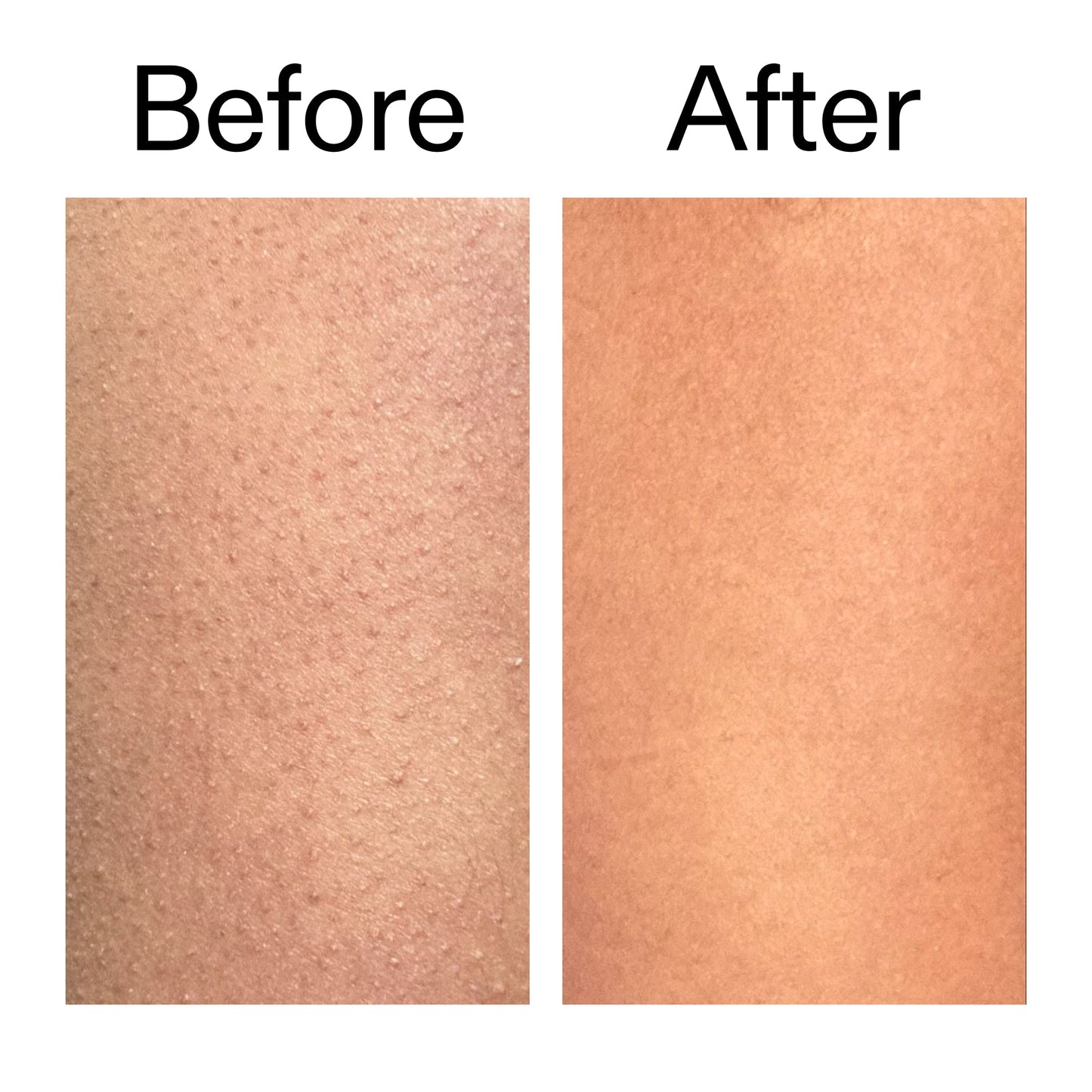 glycolic-acid-exfoliating-body-stick-e1 Glycolic_Body_Stick_B_A_2000x2000_6e6e6b4d-5bd7-43c0-aeed-4d66788e8995.jpg