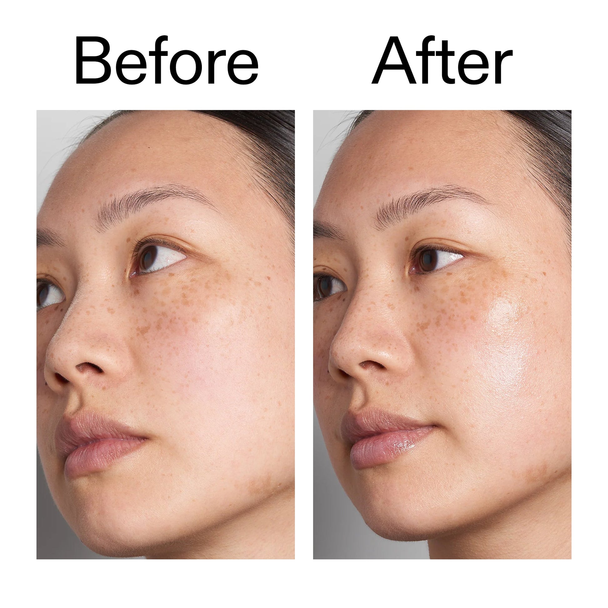 hyaluronic-acid-serum-60ml-m3 Hyaluronic_Acid_Before_After_2000x2000_d7983956-8aa2-4ea3-8255-c63e8d4f892e.jpg