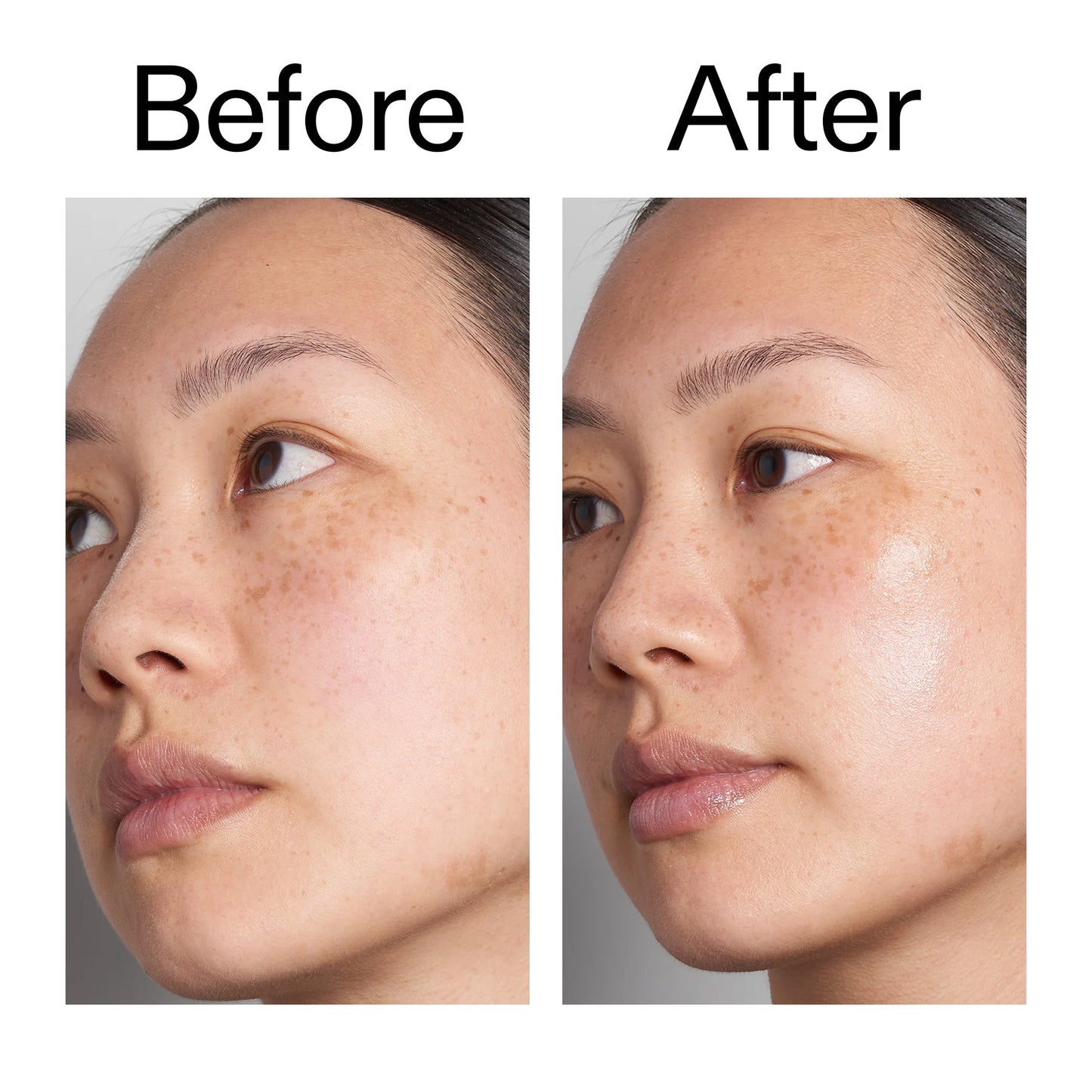 supersize-hyaluronic-acid-serum-100ml-k6 Hyaluronic_Acid_Before_After_2000x2000_d7983956-8aa2-4ea3-8255-c63e8d4f892e.jpg