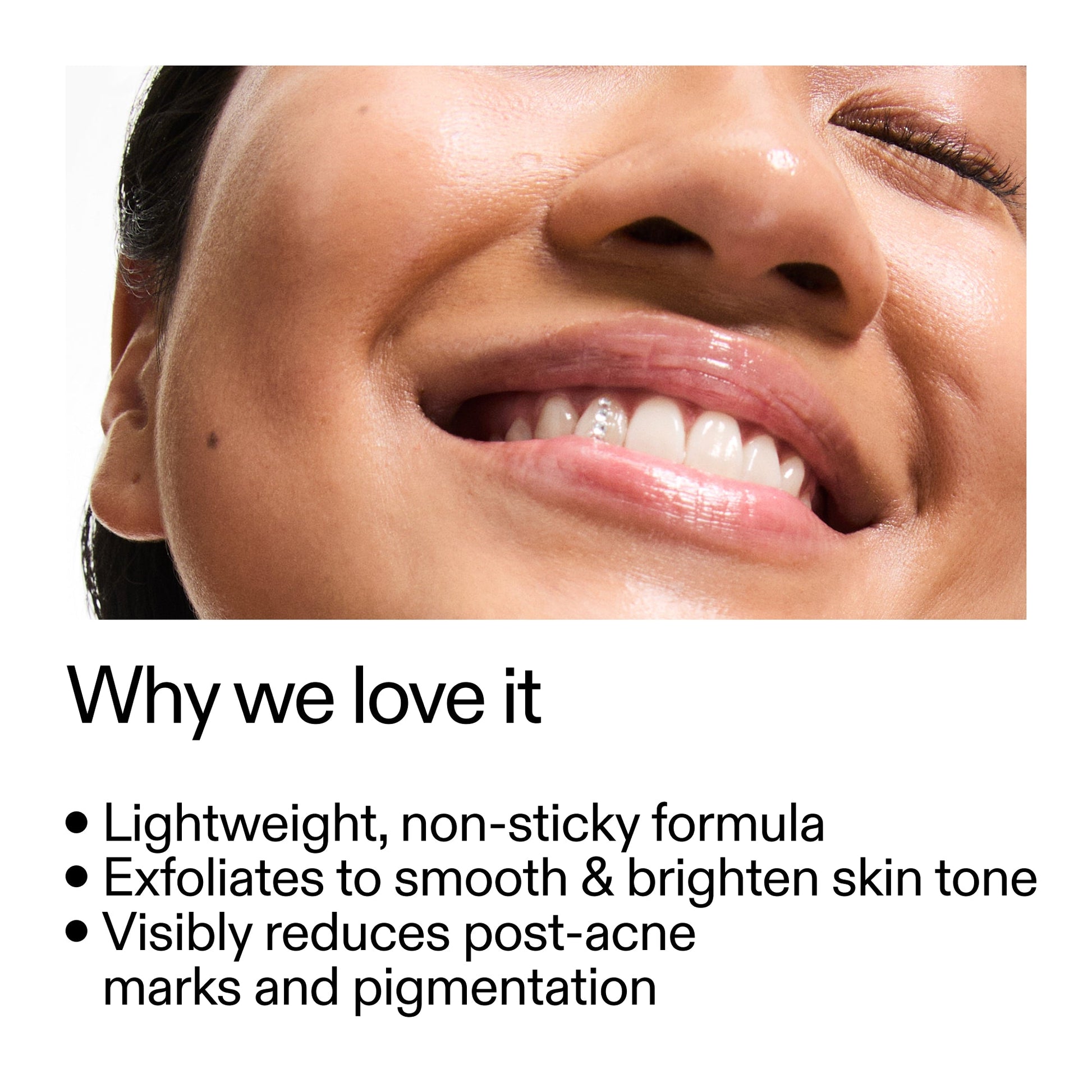 mandelic-acid-treatment-h2 Mandelic_Acid_Treatment_Why_we_love_it_2000x2000_6dfe29a9-2a79-464f-a5e8-e5ac37d93388.jpg