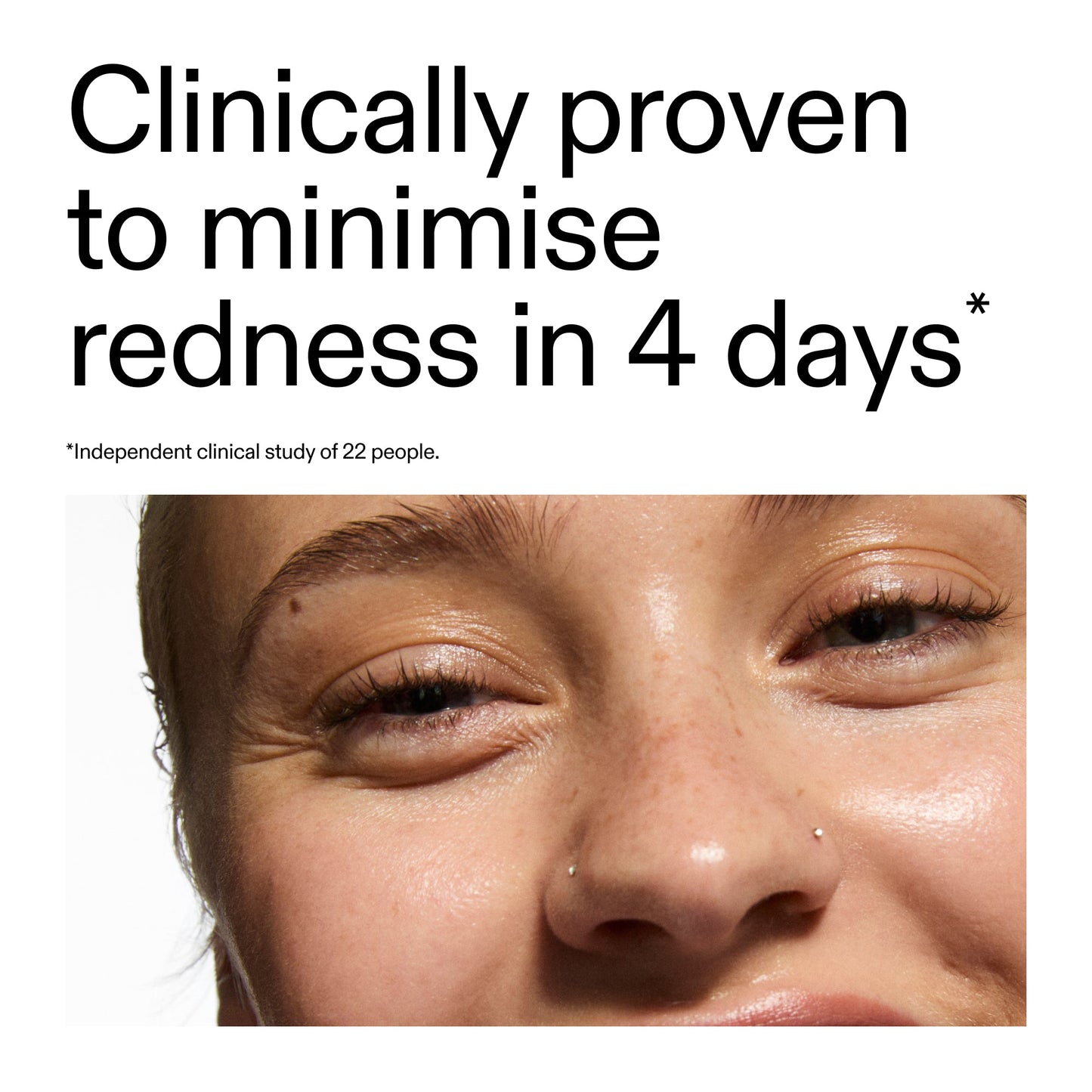 10-azelaic-acid-serum-for-redness-relief-y0 Oat_Cleansing_Balm_Claim_2000x2000_52a841dc-353c-4f2c-8646-3aadb604507d.jpg