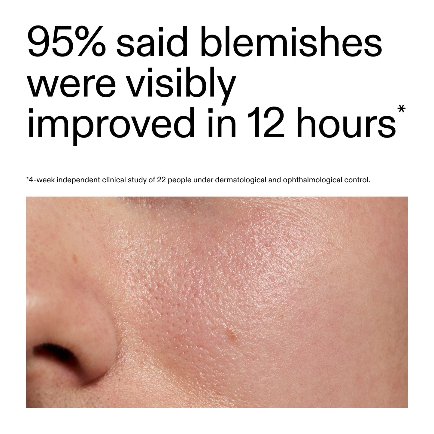 succinic-acid-acne-treatment-e0 Oat_Cleansing_Balm_Claim_2000x2000_ac6ce553-25db-41b2-a981-faae1ac4b8c0.jpg