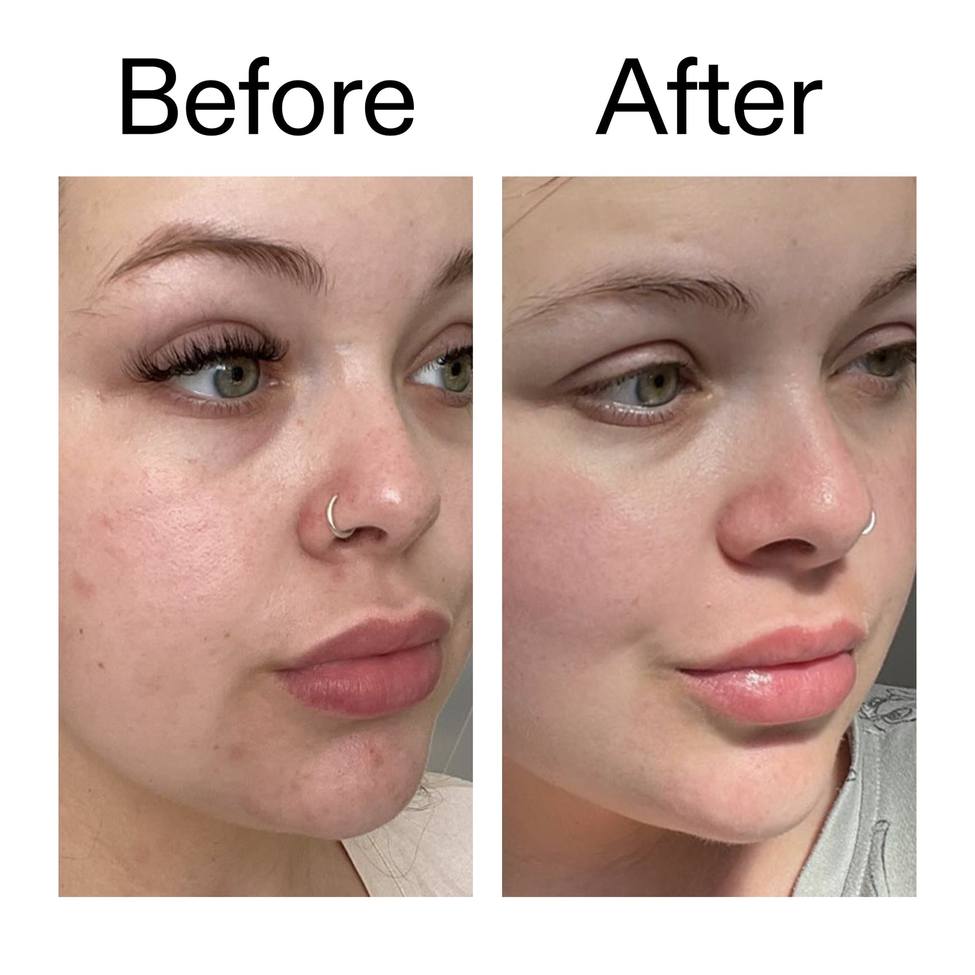 supersize-omega-water-cream-duo-t4 Omega50_Before_After_2000x2000_46483ed8-3f9d-487f-9a0c-9df79830bd65.jpg
