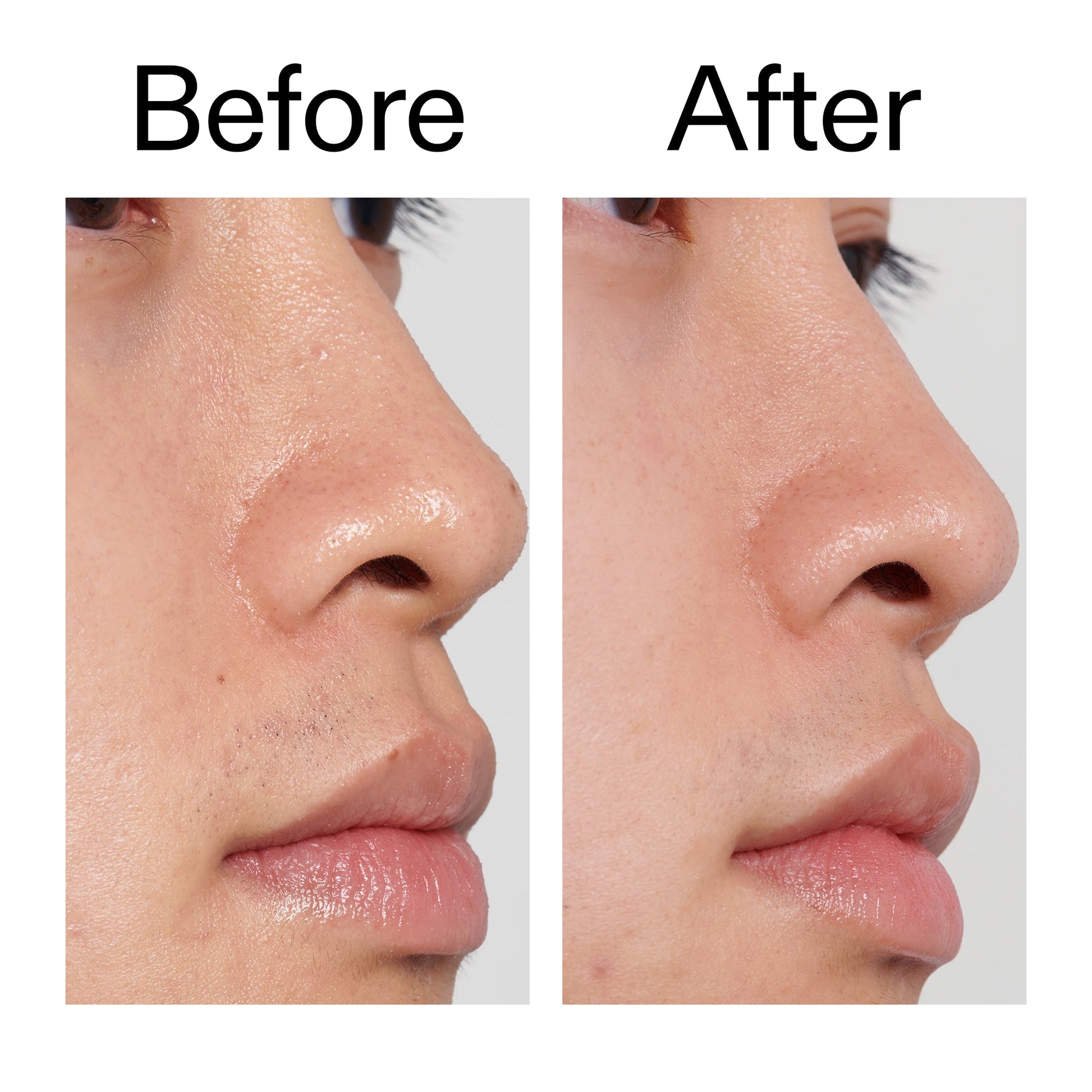 pha-toner-b0 PHA_Toner_Before_After_2000x2000_e3c10172-0150-4342-8b95-57417eaff50d.jpg