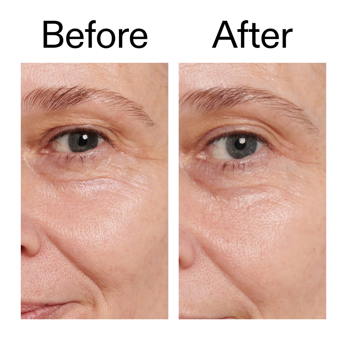 retinol-eye-cream-y9 Retinol_Eye_Cream_Before_After_2000x2000_ac03a80c-109e-4572-a95a-91dc109b4d27.jpg
