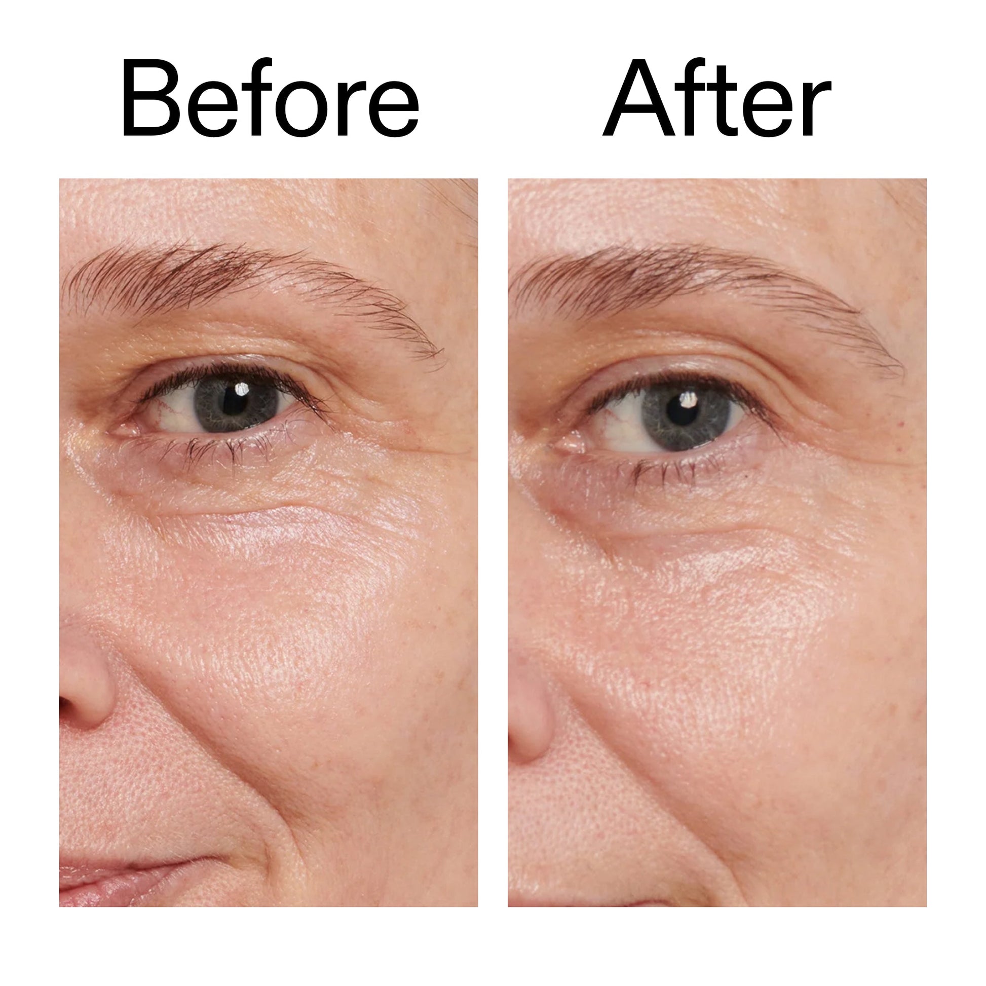 retinol-eye-cream-y9 Retinol_Eye_Cream_Before_After_2000x2000_ac03a80c-109e-4572-a95a-91dc109b4d27.jpg