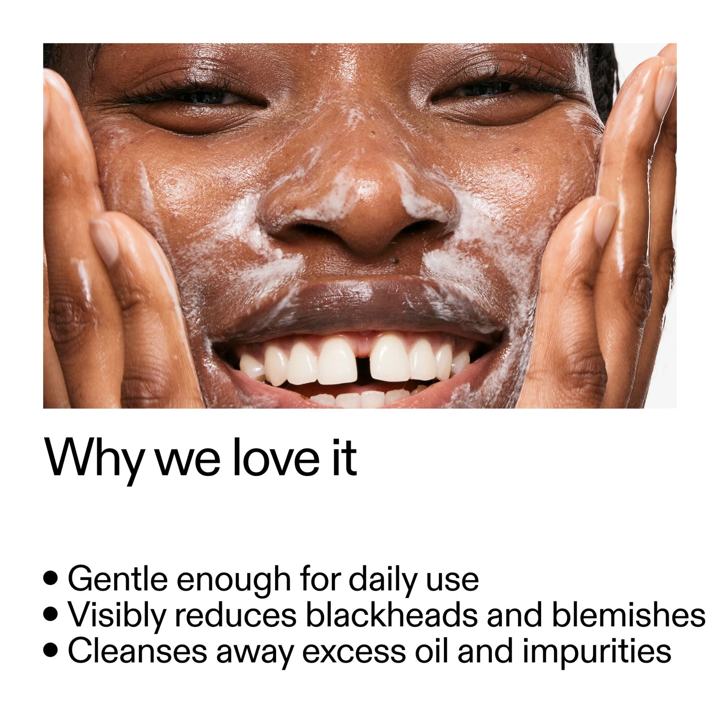 salicylic-acid-cleanser-150ml-c4 Salicylic_Acid_Cleanser_-_300mlWhy_we_love_it_2000x2000_87dc92a9-2559-4309-98cd-4e570f1be735.jpg