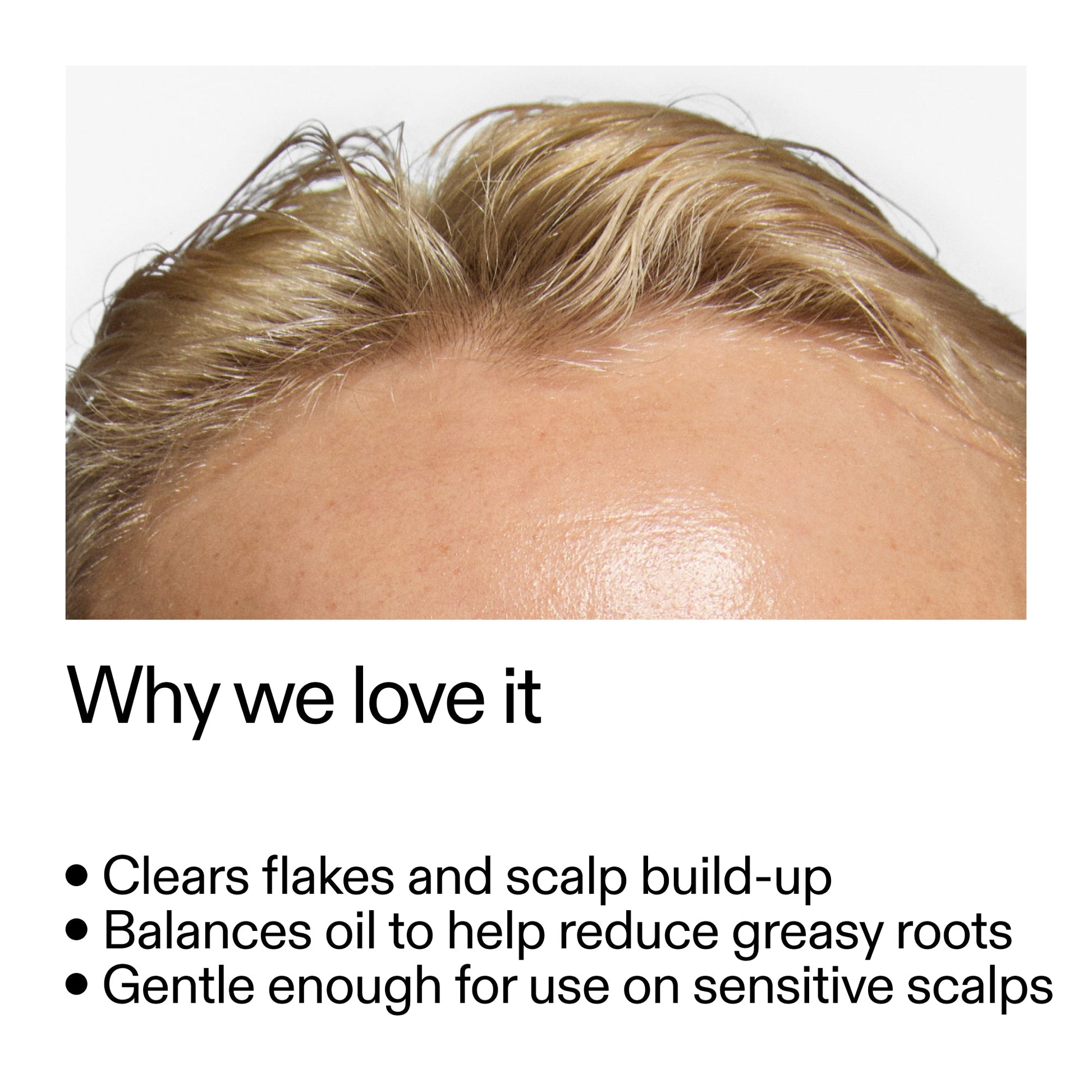 salicylic-acid-exfoliating-scalp-treatment-a7 Salicylic_Acid_Exfoliating_Scalp_Treatment_Why_we_love_it_2000x2000_44b6bd6d-9ec4-4b23-9dc4-bc3fd6f28e14.jpg