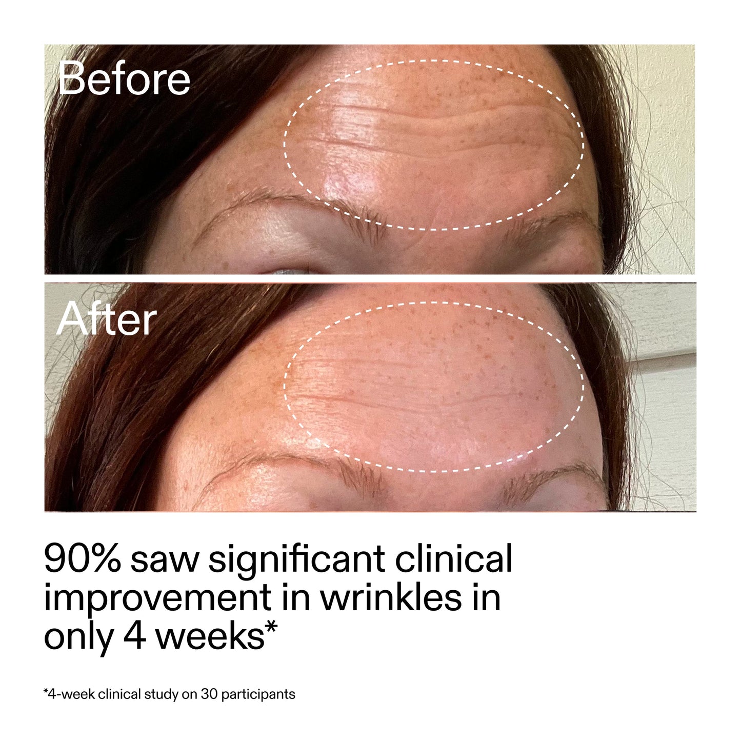 starter-retinol-serum-duo-t1 StarterRetinol_BeforeAfter_Claim1_2000x2000_03b4d6e5-a357-43b9-a855-aba5e35c57f3.jpg