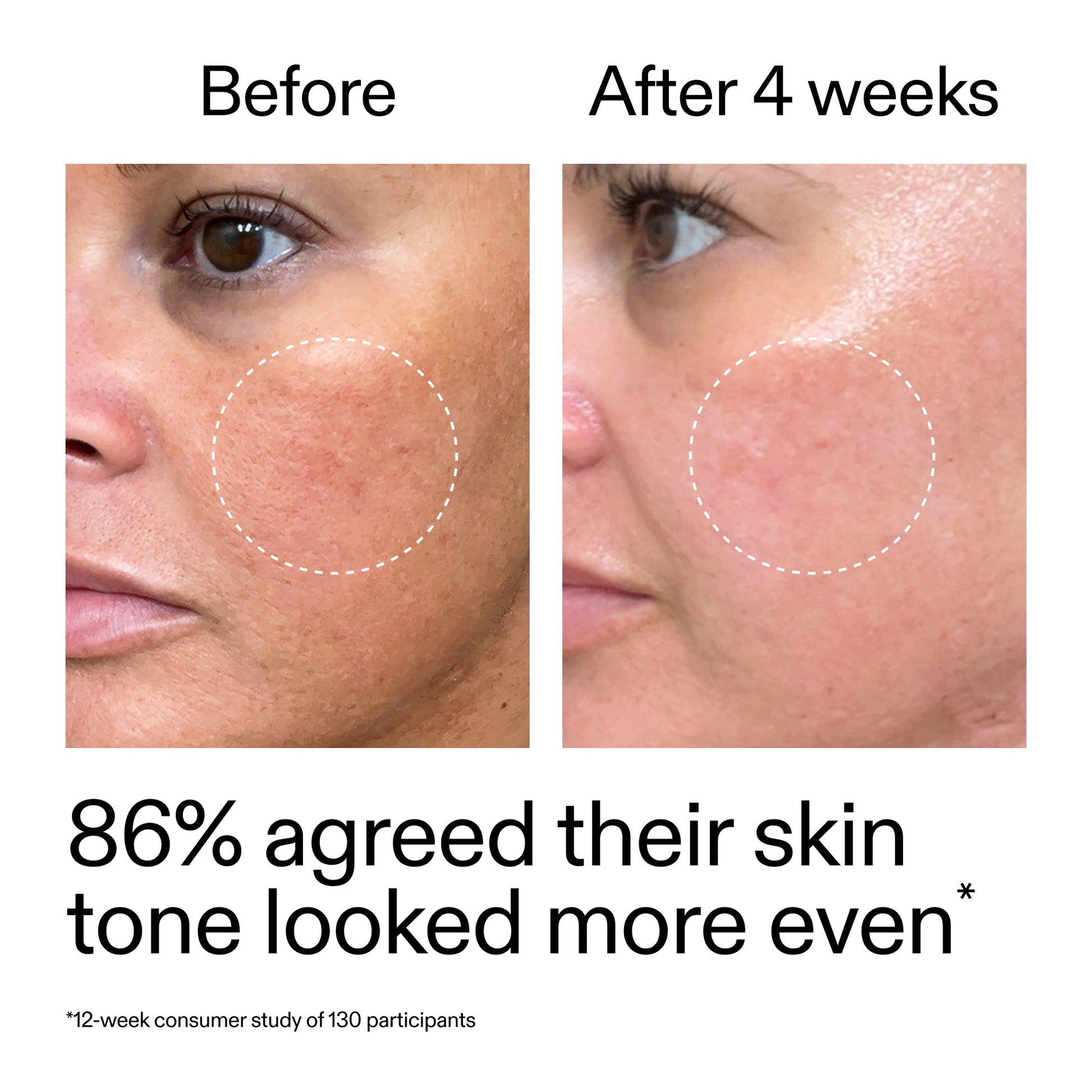 starter-retinol-serum-o8 StarterRetinol_BeforeAfter_Claim2_2000x2000_f5c9ecc0-8d76-429d-bef5-c3a61bcf5c09.jpg
