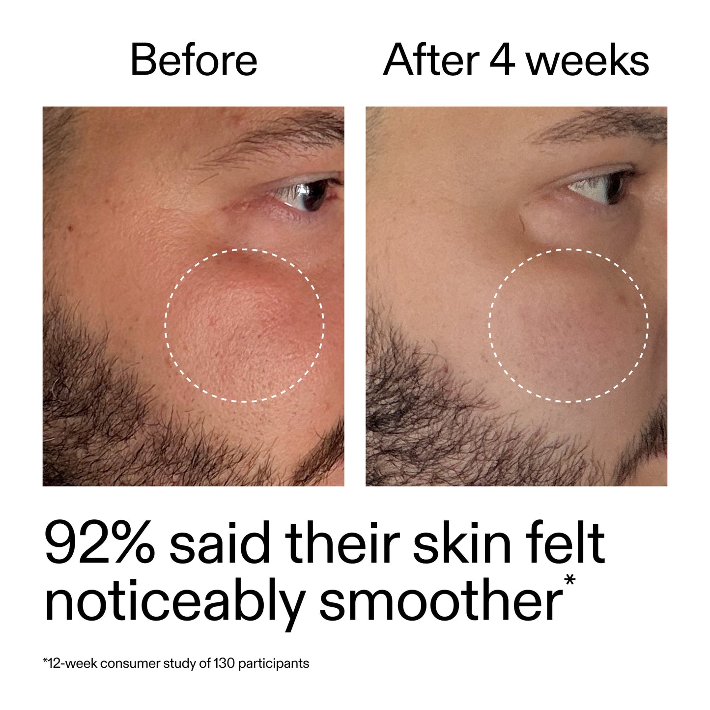 starter-retinol-serum-o8 StarterRetinol_BeforeAfter_Claim3_2000x2000_6ceab106-e0ee-4ed4-ba62-41bc39538038.jpg