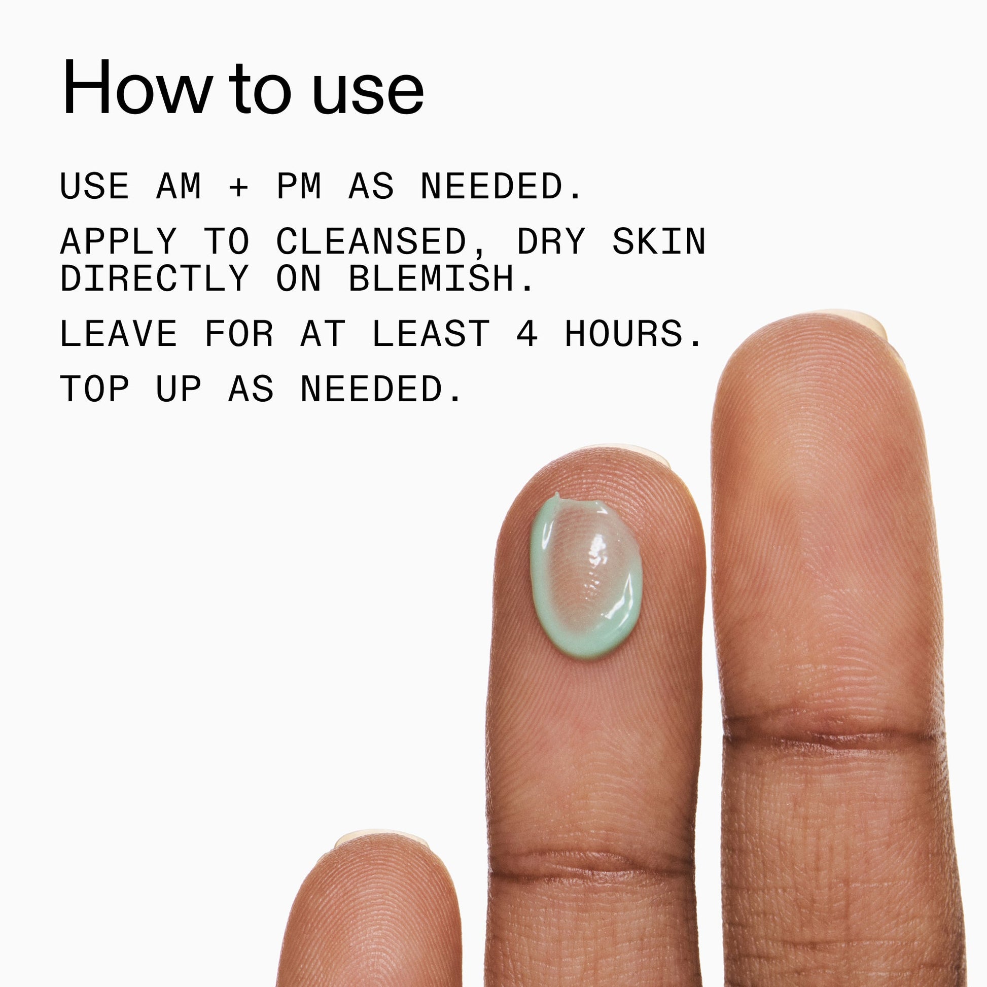 succinic-acid-acne-treatment-e0 Succinic_Acid_Treatment_How_to_Use_2000x2000_d57137d5-d7f1-427c-9a46-5fc00c19c542.jpg