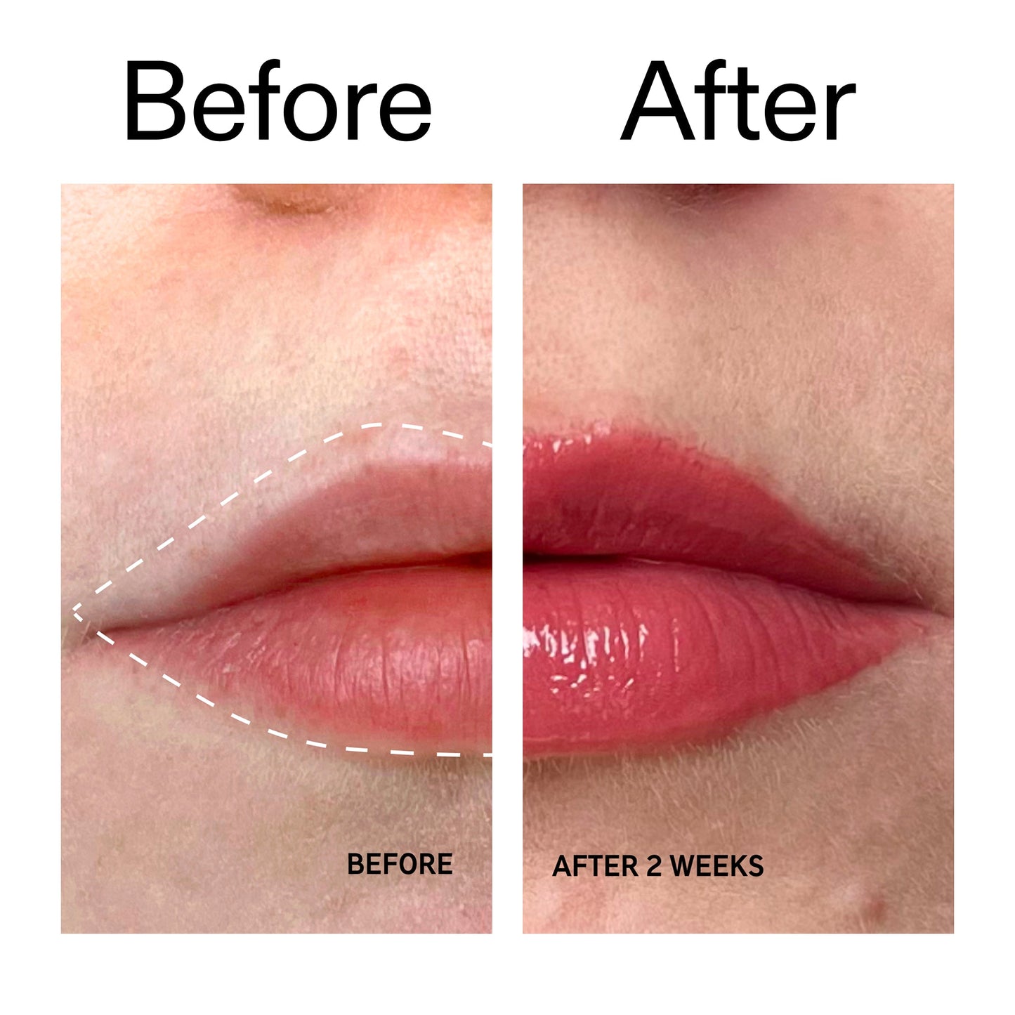 tripeptide-plumping-berry-lip-balm-t7 Tripeptide_Plumping_Lip_Balm_-_Berry_Before_After_2000x2000_9474bbd8-43ca-4b0e-b0e7-dfab70b91927.jpg