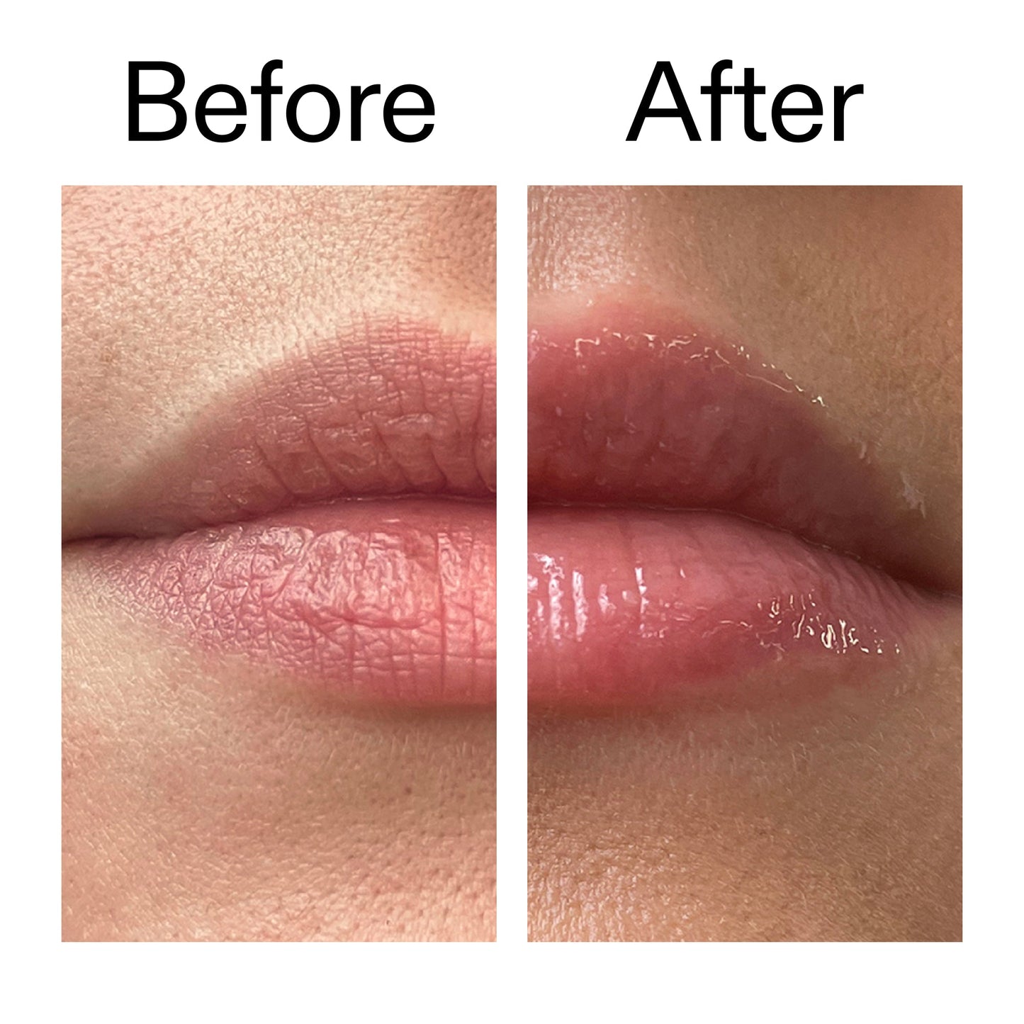 tripeptide-plumping-lip-balm-n6 Tripeptide_Plumping_Lip_Balm_Before_After_2000x2000_b4a5ee04-d2ac-4857-8f01-17209acc4bf3.jpg