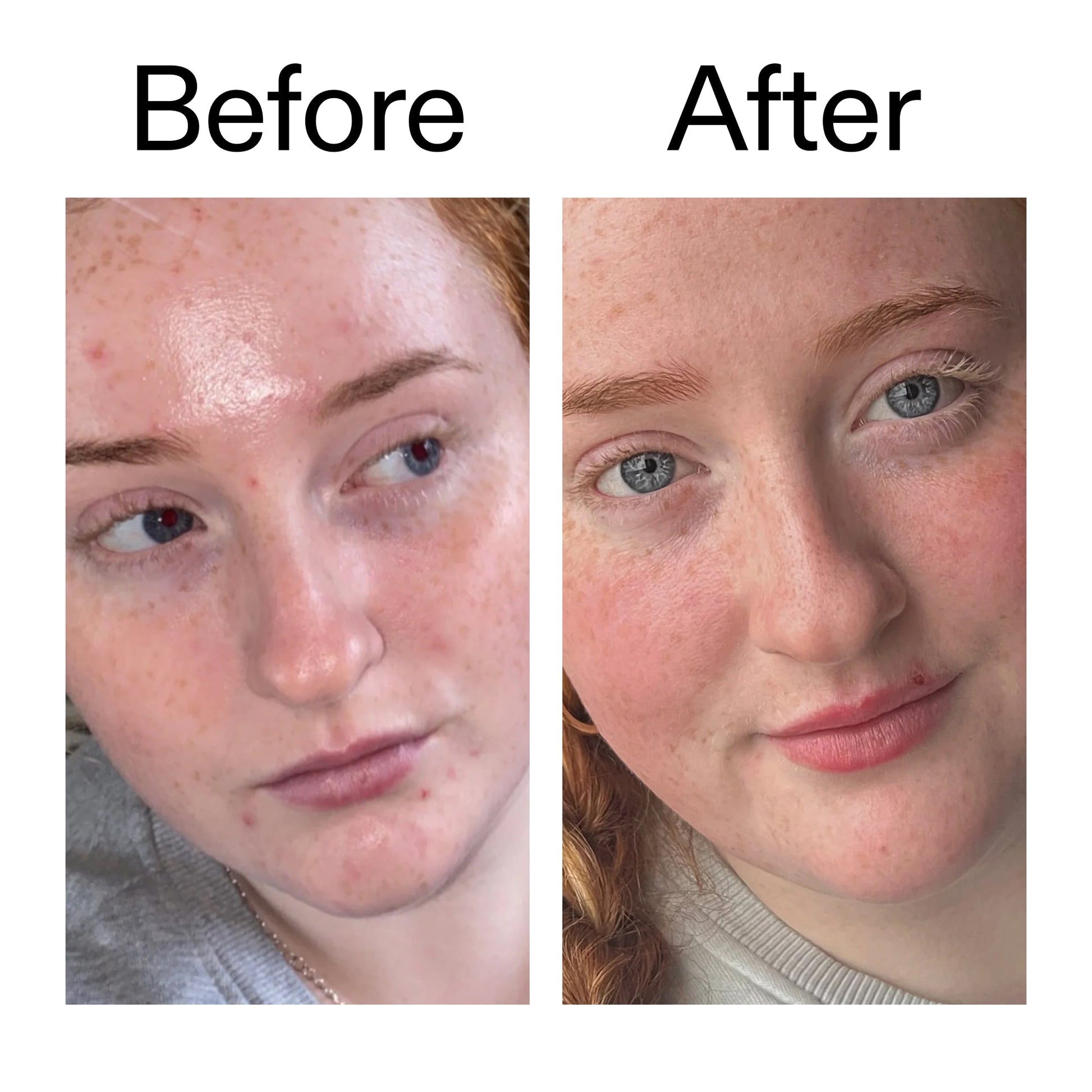 vitamin-b-c-and-e-moisturizer-t4 Vitamin_B_C_and_E_Moisturizer_Before_After_2000x2000_b0781a76-5ad2-4be9-95b8-ef92b356833c.jpg